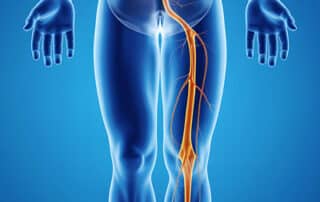 Pain down your leg? 6 signs you may have a pinched nerve or herniated disc